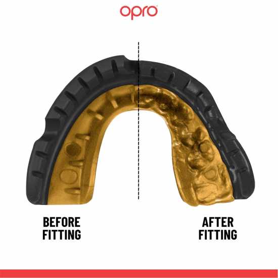 Opro Gld Slf Ft Brce 00  Боксови протектори за уста